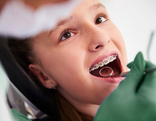 Orthodontie de l’adolescent 